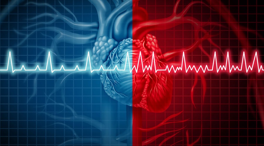 Target heart rate on a beta blocker Doctor Benjamin Díaz Curiel